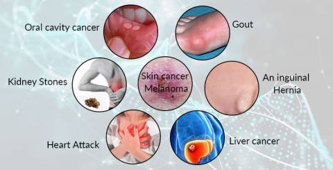 7 Diseases That Can Influence Men More than Women 7 Diseases That Can Influence Men More than Women